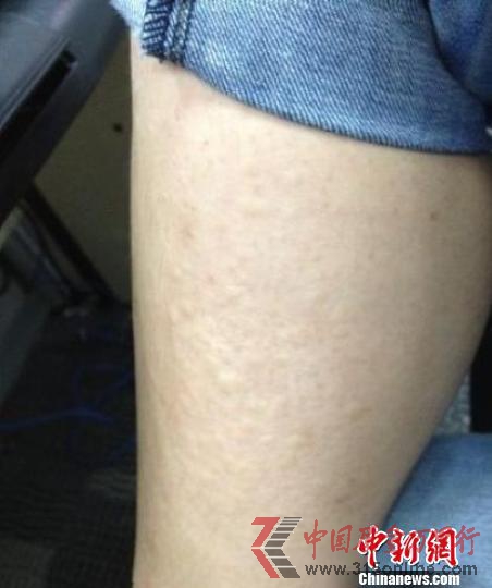 南京水魔方致游客瘙癢衛(wèi)生部門稱余氯含量超標